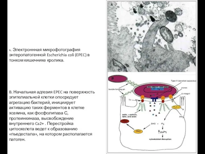 A. Электроннная микрофотография энтеропатогенной Escherichia coli (EPEC) в тонком кишечнике кролика.