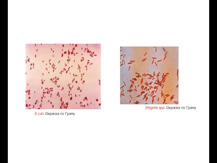 E.coli. Окраска по Граму Shigella spp. Окраска по Граму