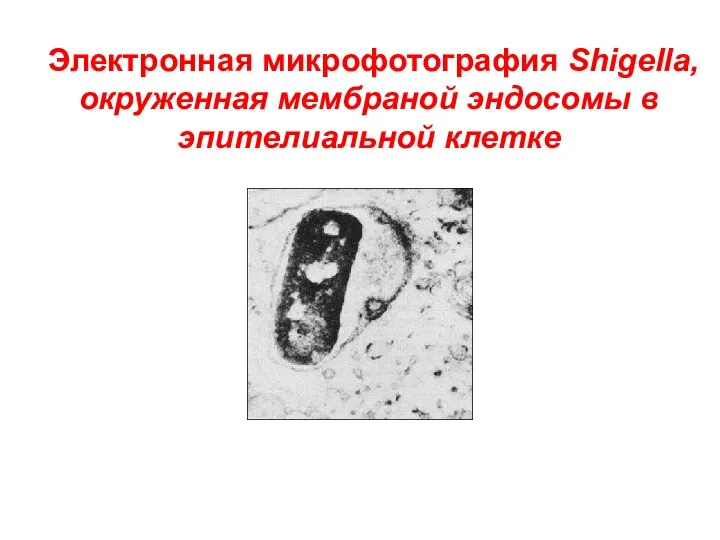 Электронная микрофотография Shigella, окруженная мембраной эндосомы в эпителиальной клетке