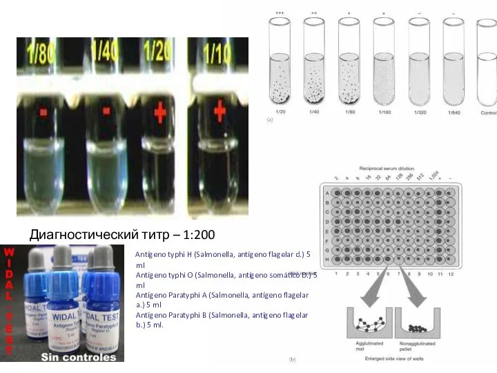 Диагностический титр – 1:200 Antígeno typhi H (Salmonella, antígeno flagelar d.)