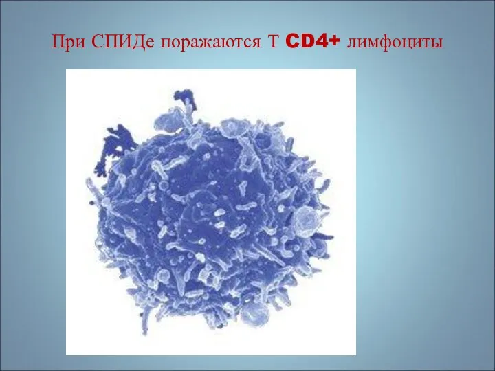 При СПИДе поражаются Т CD4+ лимфоциты