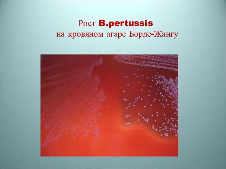 Рост B.pertussis на кровяном агаре Борде-Жангу