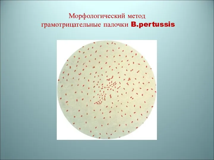 Морфологический метод грамотрицательные палочки B.pertussis