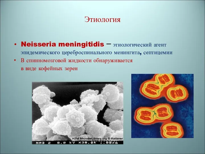 Этиология Neisseria meningitidis – этиологический агент эпидемического цереброспинального менингита, септицемии В