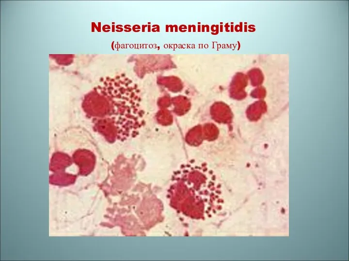 Neisseria meningitidis (фагоцитоз, окраска по Граму)