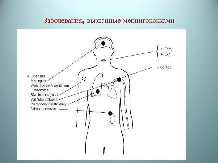 Заболевания, вызванные менингококками