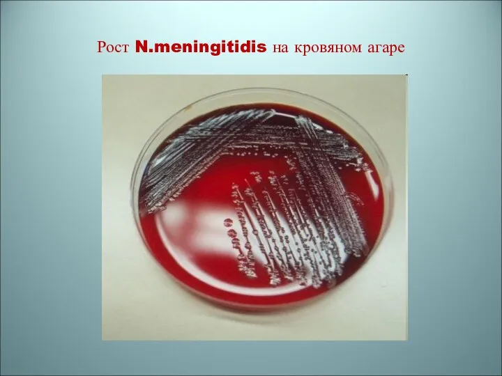 Рост N.meningitidis на кровяном агаре