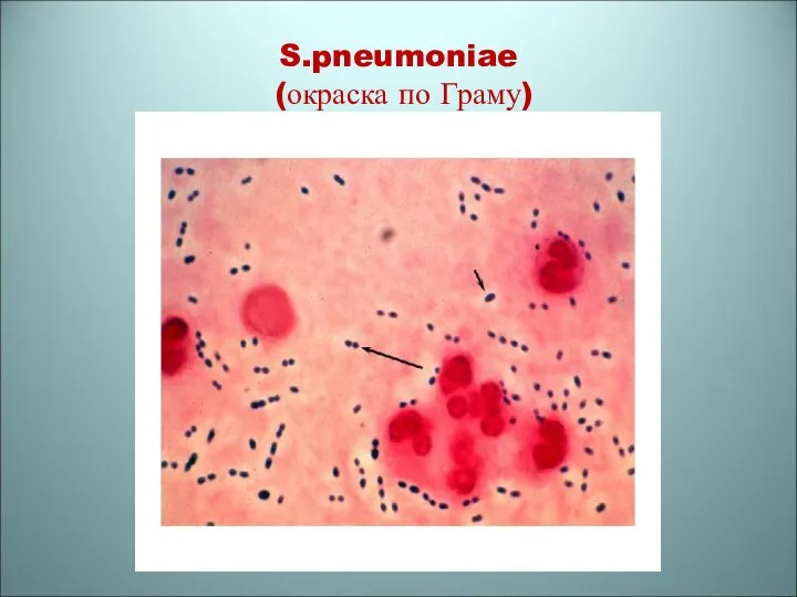 S.pneumoniae (окраска по Граму)