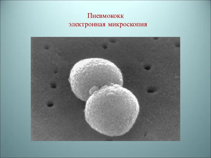 Пневмококк электронная микроскопия