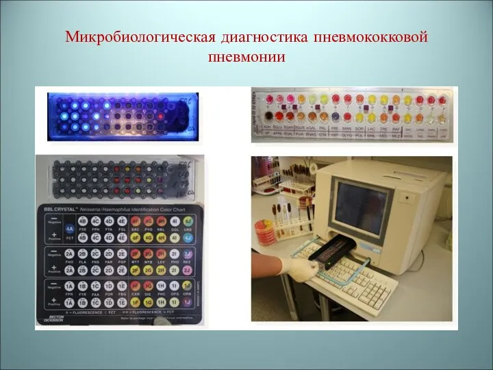 Микробиологическая диагностика пневмококковой пневмонии