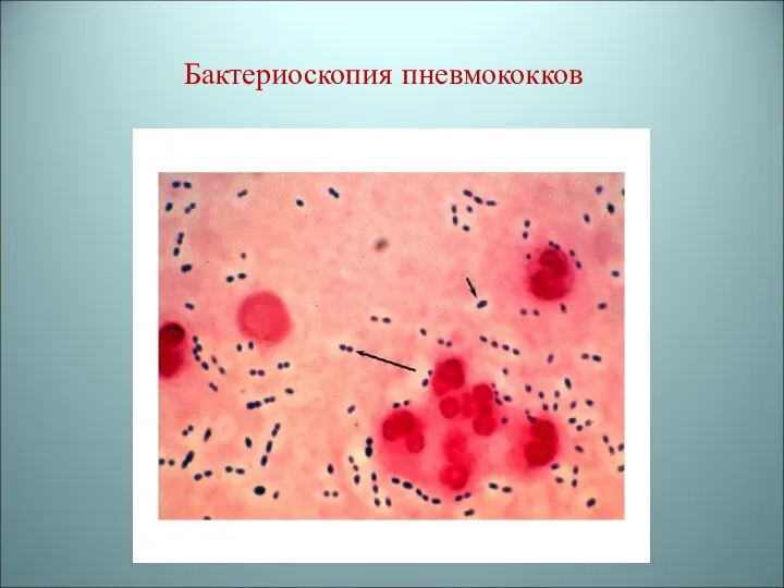 Бактериоскопия пневмококков