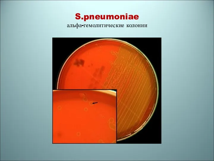 S.pneumoniae альфа-гемолитические колонии