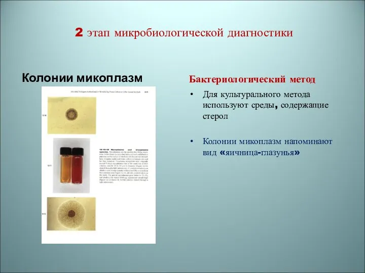 2 этап микробиологической диагностики Колонии микоплазм Бактериологический метод Для культурального метода