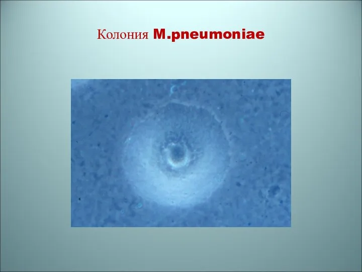 Колония M.pneumoniae
