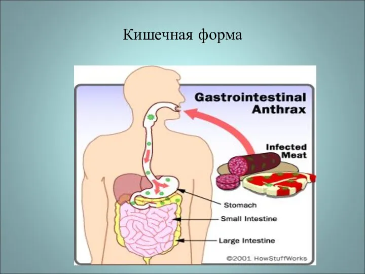 Кишечная форма