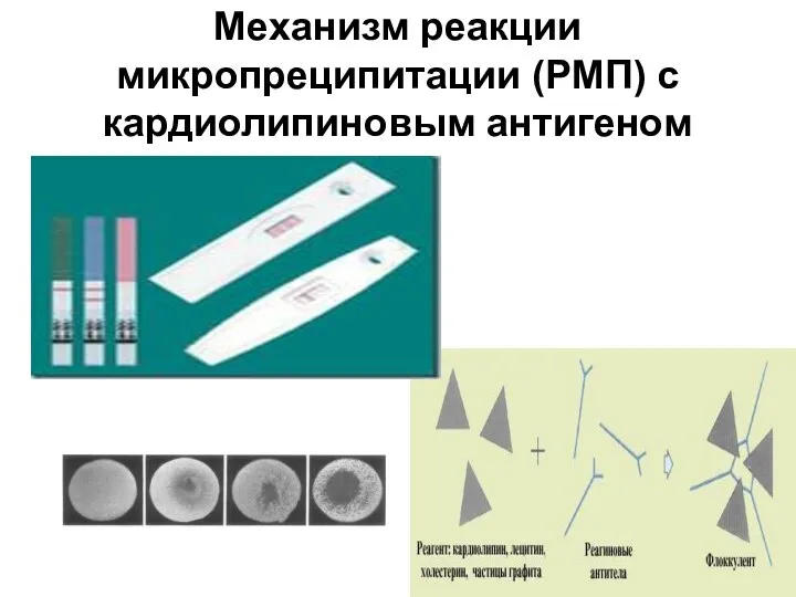 Механизм реакции микропреципитации (РМП) с кардиолипиновым антигеном