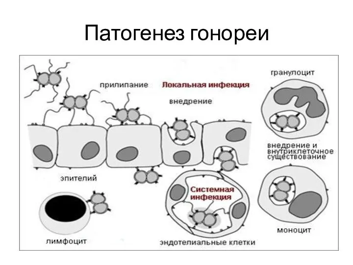 Патогенез гонореи