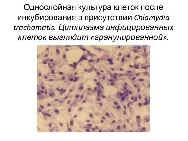 Однослойная культура клеток после инкубирования в присутствии Chlamydia trachomatis. Цитплазма инфицированных клеток выглядит «гранулированной».