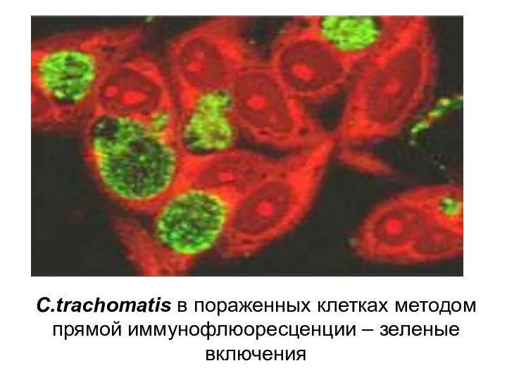 C.trachomatis в пораженных клетках методом прямой иммунофлюоресценции – зеленые включения