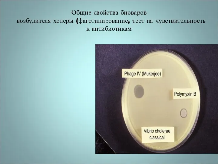 Общие свойства биоваров возбудителя холеры (фаготипирование, тест на чувствительность к антибиотикам