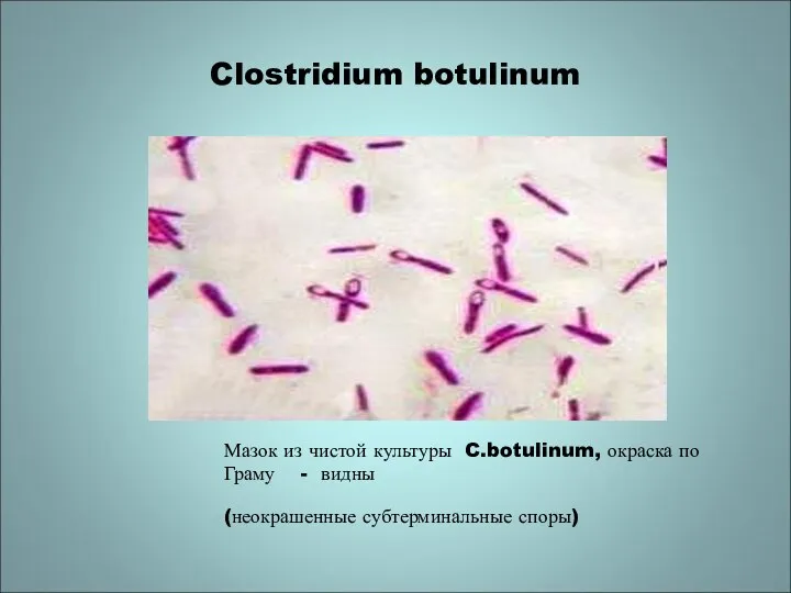 Clostridium botulinum Мазок из чистой культуры C.botulinum, окраска по Граму - видны (неокрашенные субтерминальные споры)