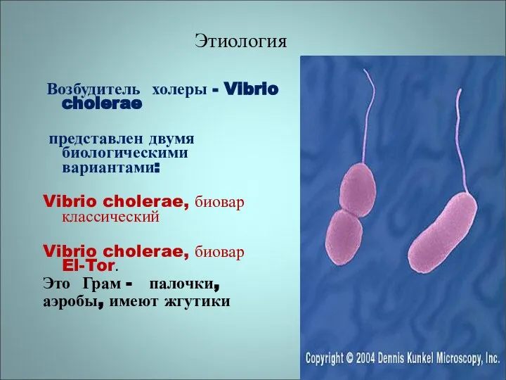 Этиология Возбудитель холеры - Vibrio cholerae представлен двумя биологическими вариантами: Vibrio