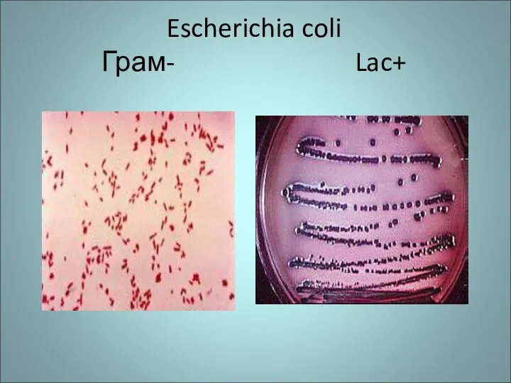 Escherichia coli Грам- Lac+