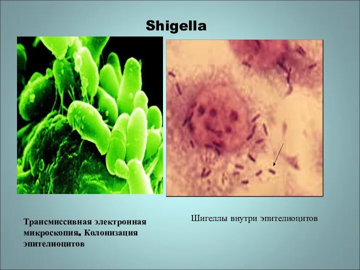 Shigella Трансмиссивная электронная микроскопия. Колонизация эпителиоцитов Шигеллы внутри эпителиоцитов