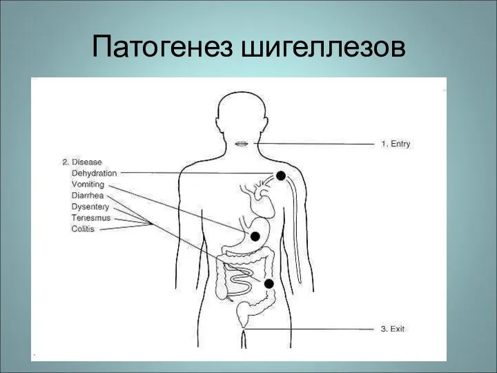 Патогенез шигеллезов