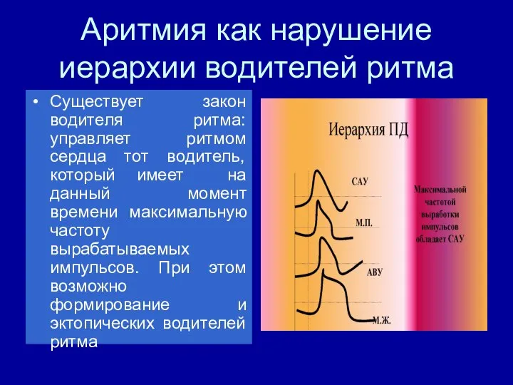 Аритмия как нарушение иерархии водителей ритма Существует закон водителя ритма: управляет