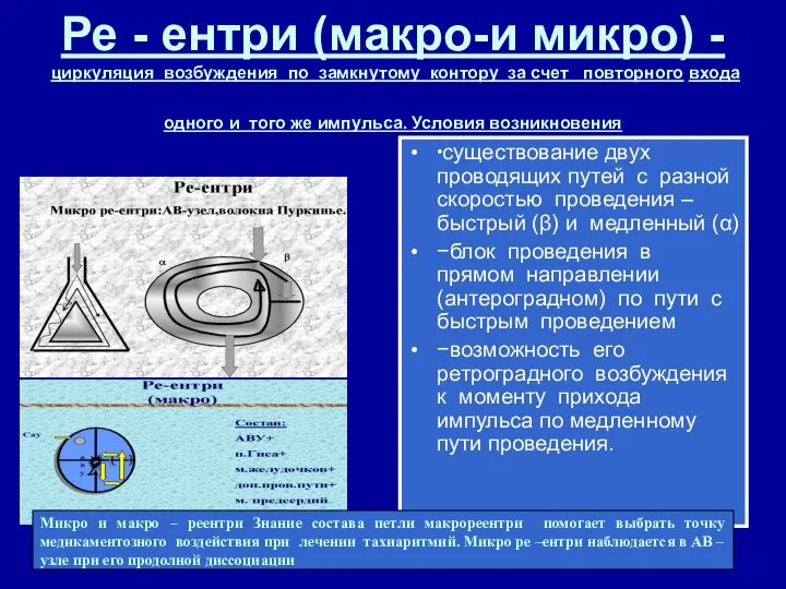 Ре - ентри (макро-и микро) - циркуляция возбуждения по замкнутому контору