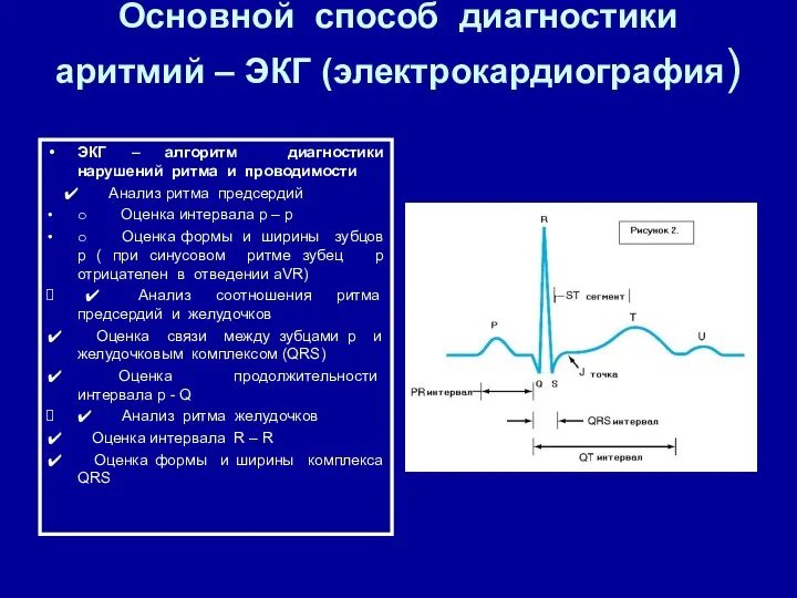 Основной способ диагностики аритмий – ЭКГ (электрокардиография) ЭКГ – алгоритм диагностики