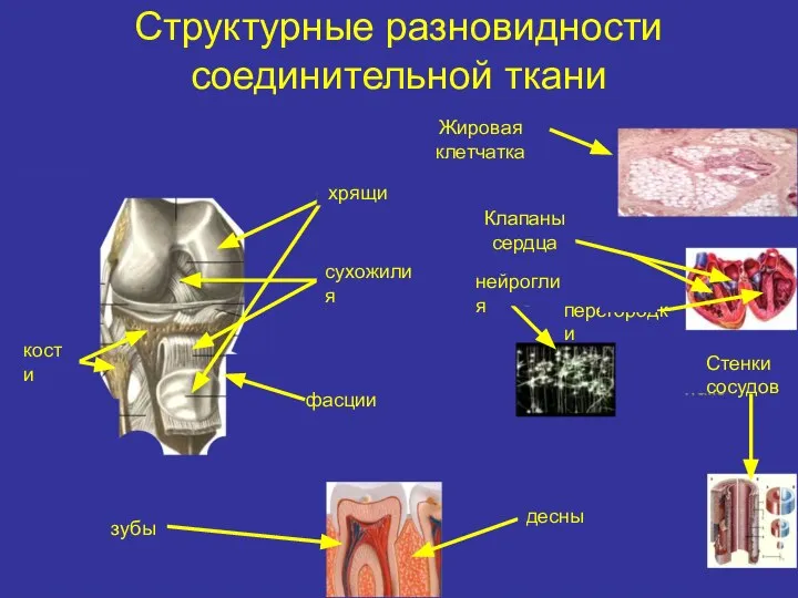 Структурные разновидности соединительной ткани Жировая клетчатка хрящи Клапаны сердца сухожилия кости