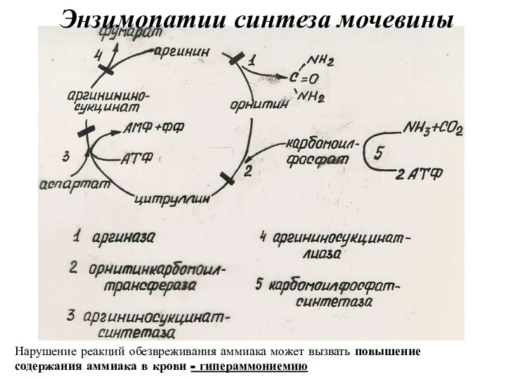 Энзимопатии синтеза мочевины Нарушение реакций обезвреживания аммиака может вызвать повышение содержания аммиака в крови - гипераммониемию