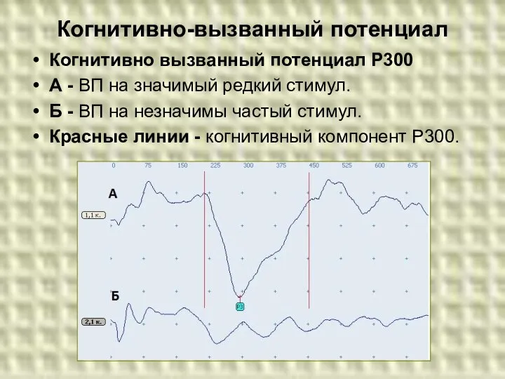 Когнитивно-вызванный потенциал Когнитивно вызванный потенциал Р300 А - ВП на значимый