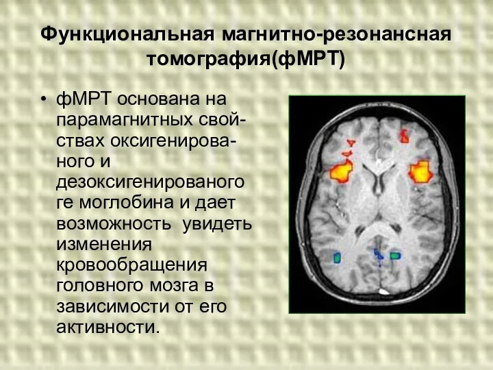 Функциональная магнитно-резонансная томография(фМРТ) фМРТ основана на парамагнитных свой-ствах оксигенирова- ного и