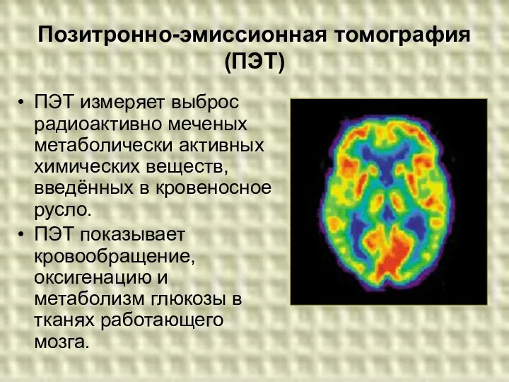 Позитронно-эмиссионная томография (ПЭТ) ПЭТ измеряет выброс радиоактивно меченых метаболически активных химических