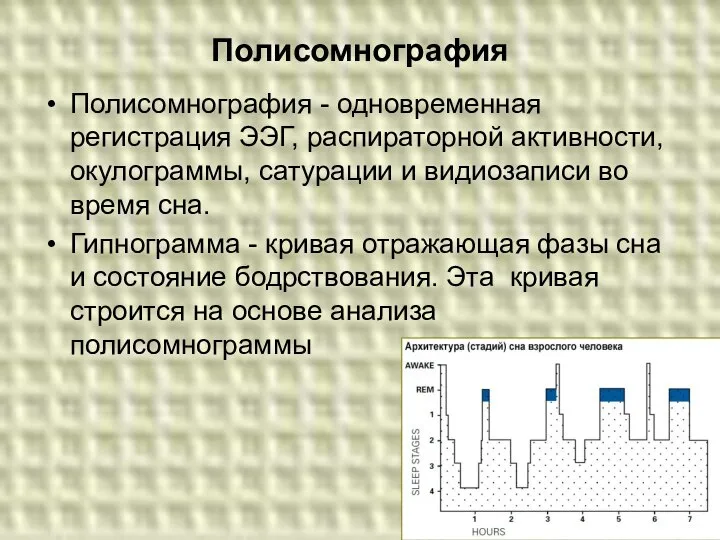 Полисомнография Полисомнография - одновременная регистрация ЭЭГ, распираторной активности, окулограммы, сатурации и