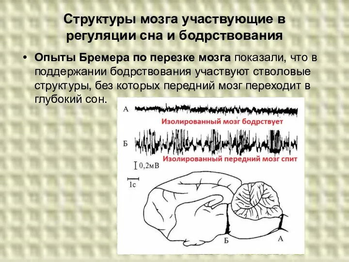 Структуры мозга участвующие в регуляции сна и бодрствования Опыты Бремера по