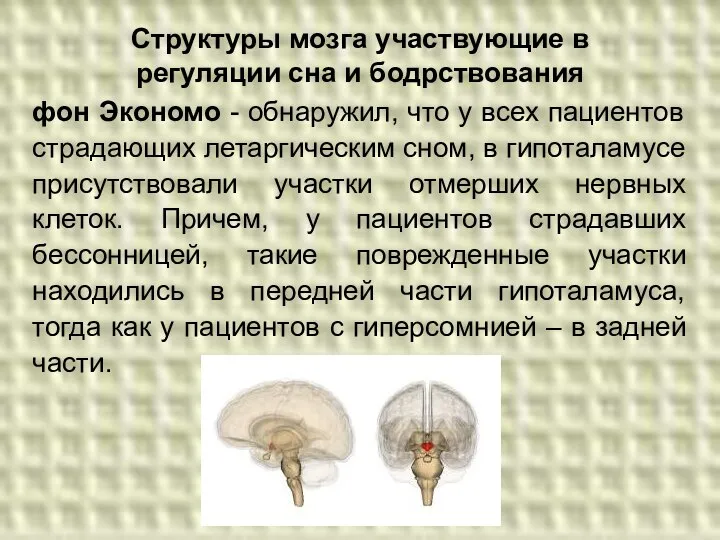 фон Экономо - обнаружил, что у всех пациентов страдающих летаргическим сном,