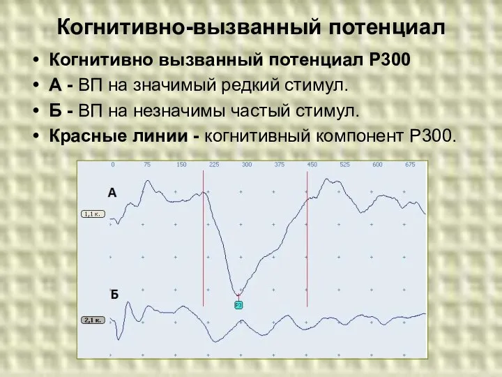 Когнитивно-вызванный потенциал Когнитивно вызванный потенциал Р300 А - ВП на значимый