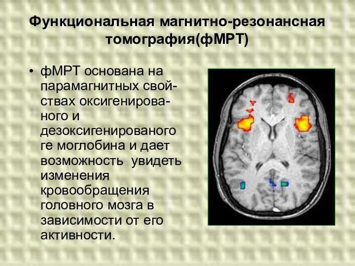 Функциональная магнитно-резонансная томография(фМРТ) фМРТ основана на парамагнитных свой-ствах оксигенирова- ного и