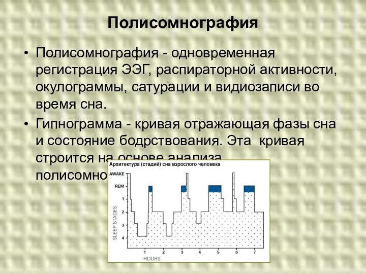 Полисомнография Полисомнография - одновременная регистрация ЭЭГ, распираторной активности, окулограммы, сатурации и