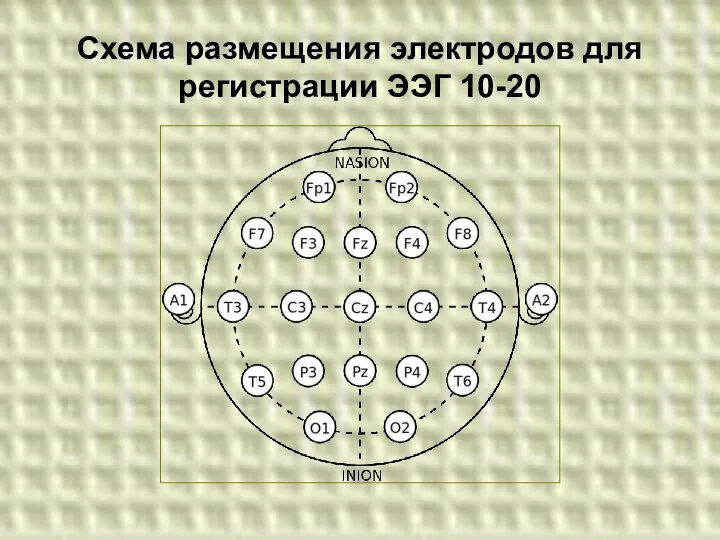 Схема размещения электродов для регистрации ЭЭГ 10-20