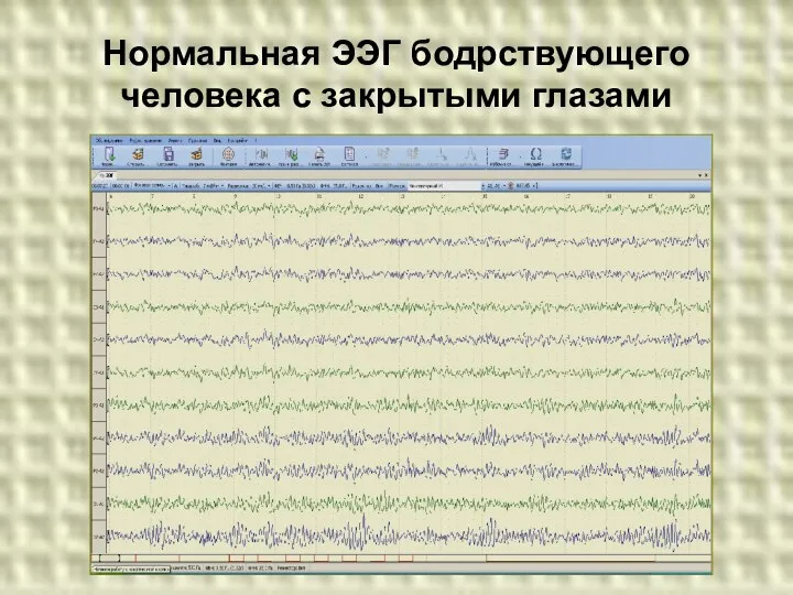 Нормальная ЭЭГ бодрствующего человека с закрытыми глазами