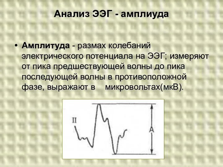 Анализ ЭЭГ - амплиуда Амплитуда - размах колебаний электрического потенциала на