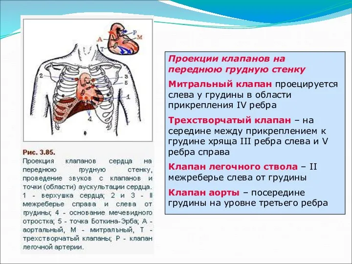 Проекции клапанов на переднюю грудную стенку Митральный клапан проецируется слева у