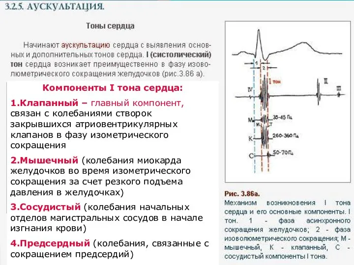 Компоненты I тона сердца: 1.Клапанный – главный компонент, связан с колебаниями