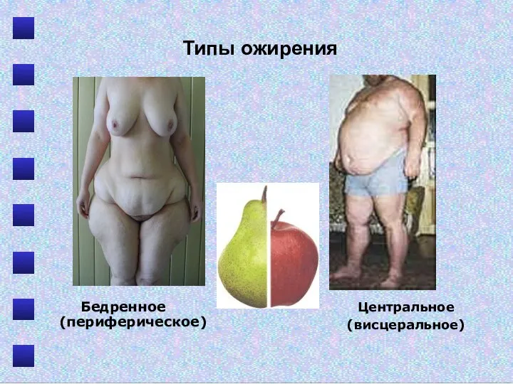Типы ожирения Бедренное (периферическое) Центральное (висцеральное)