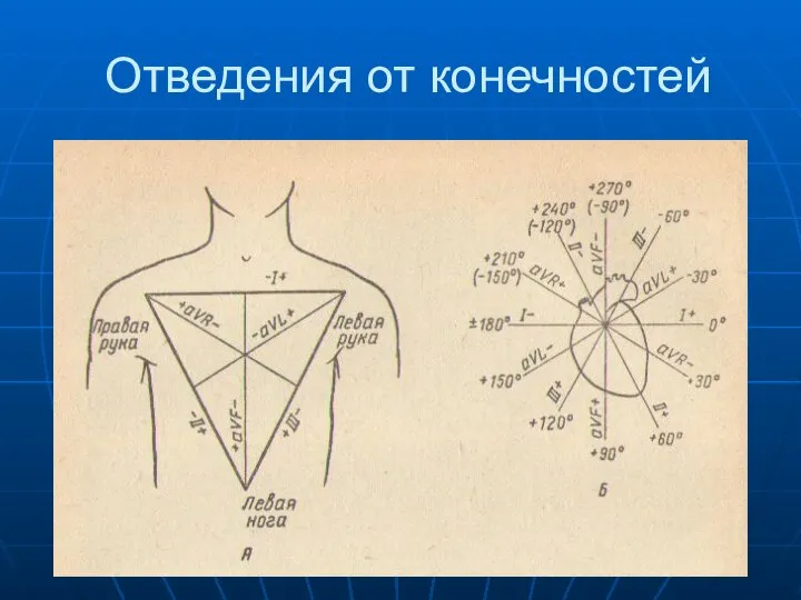 Отведения от конечностей